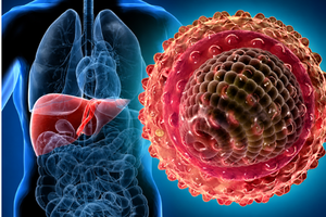 Transplant Assessment